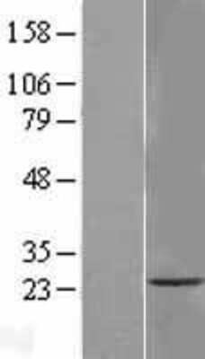 Western Blot: TMEM33 Overexpression Lysate [NBL1-17073]