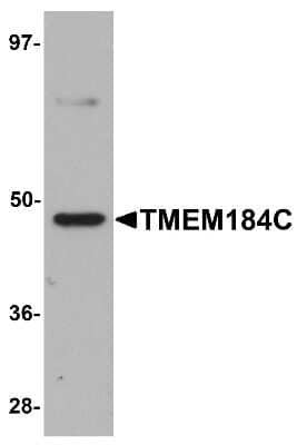 Western Blot: TMEM34 AntibodyBSA Free [NBP1-77144]