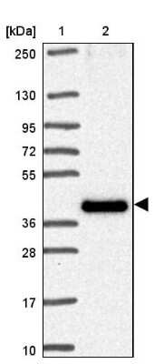 Western Blot: TMEM34 Antibody [NBP2-30760]