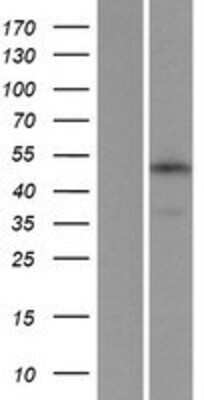 Western Blot: TMEM34 Overexpression Lysate [NBP2-06834]