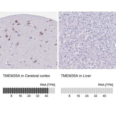 Immunohistochemistry-Paraffin: TMEM35 Antibody [NBP2-31877]