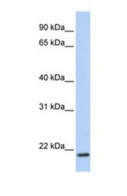 Western Blot: TMEM35 Antibody [NBP1-69343]