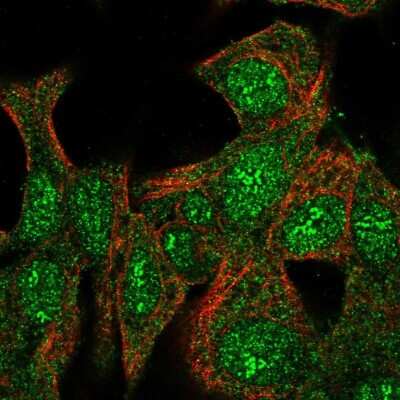 Immunocytochemistry/ Immunofluorescence: TMEM37 Antibody [NBP2-47602]