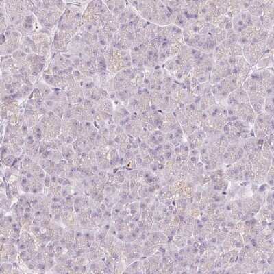 Immunohistochemistry-Paraffin: TMEM37 Antibody [NBP2-47602]