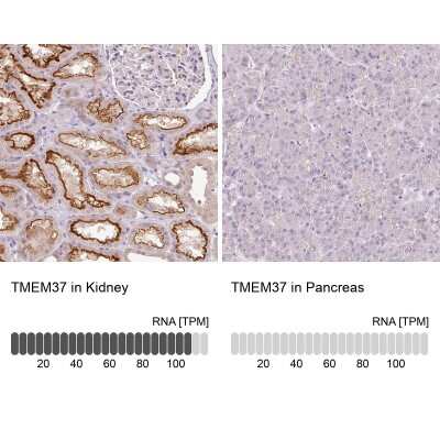 Immunohistochemistry-Paraffin: TMEM37 Antibody [NBP2-47602]