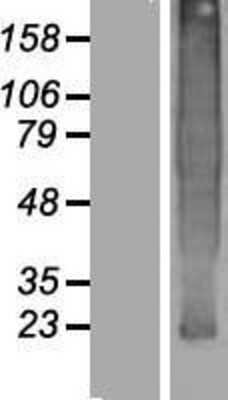 Western Blot: TMEM37 Overexpression Lysate [NBP2-04781]