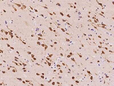 Immunohistochemistry-Paraffin: TMEM38A Antibody [NBP2-97578]