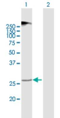 Western Blot: TMEM38A Antibody [H00079041-B01P]