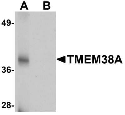 Western Blot: TMEM38A AntibodyBSA Free [NBP1-76247]