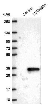 Western Blot: TMEM38A Antibody [NBP2-13452]