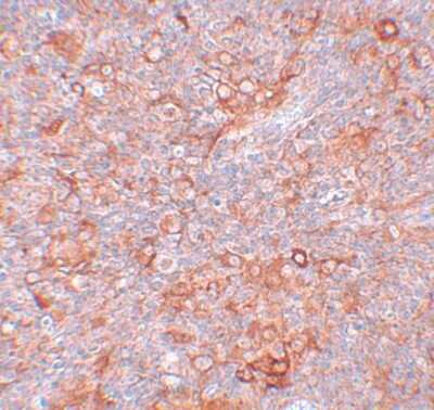 Immunohistochemistry-Paraffin: TMEM38B Antibody - BSA Free [NBP1-77093]