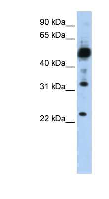 Western Blot: TMEM38B Antibody [NBP1-59976]