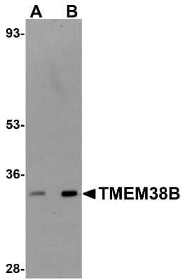 Western Blot: TMEM38B AntibodyBSA Free [NBP1-77093]