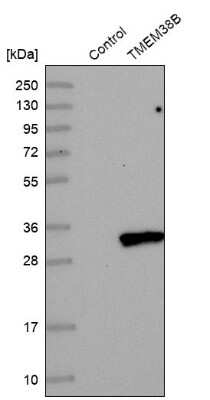 Western Blot: TMEM38B Antibody [NBP1-88803]