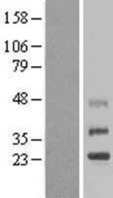 Western Blot: TMEM38B Overexpression Lysate [NBL1-17076]