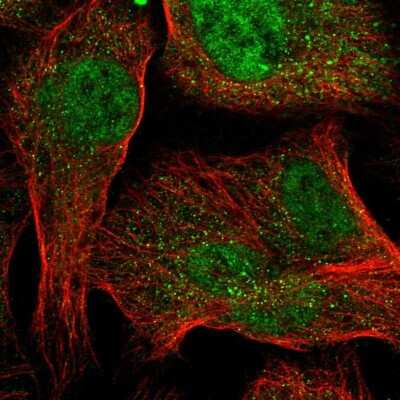 Immunocytochemistry/ Immunofluorescence: TMEM39A Antibody [NBP1-83813]