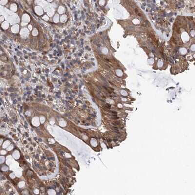 Immunohistochemistry-Paraffin: TMEM39B Antibody [NBP1-83869]