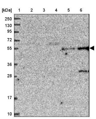 Western Blot: TMEM39B Antibody [NBP1-83868]