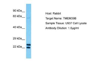 Western Blot: TMEM39B Antibody [NBP2-85950]