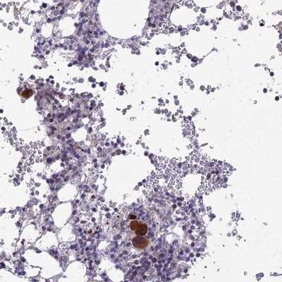 Immunohistochemistry-Paraffin: TMEM40 Antibody [NBP1-92521]