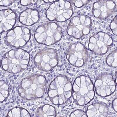 Immunohistochemistry-Paraffin: TMEM40 Antibody [NBP1-92521]