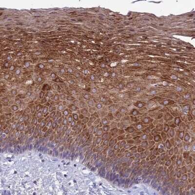 Immunohistochemistry-Paraffin: TMEM40 Antibody [NBP1-92521]