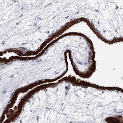 Immunohistochemistry-Paraffin: TMEM40 Antibody [NBP3-17144]