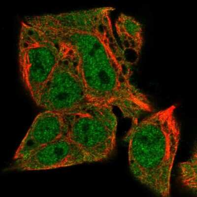 Immunocytochemistry/ Immunofluorescence: TMEM41A Antibody [NBP2-31743]