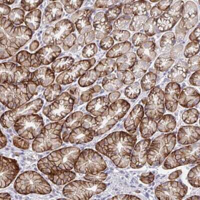 Immunohistochemistry-Paraffin: TMEM41A Antibody [NBP2-31743]