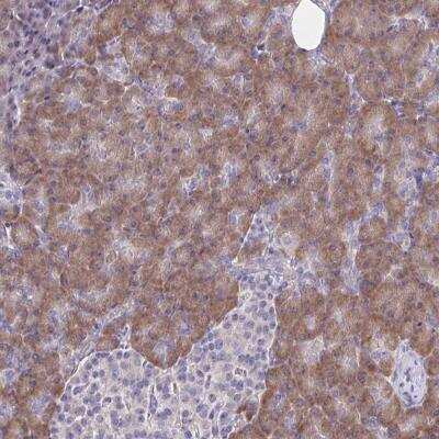 Immunohistochemistry-Paraffin: TMEM41A Antibody [NBP2-31796]