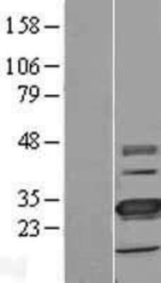 Western Blot: TMEM41A Overexpression Lysate [NBL1-17078]