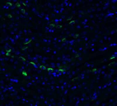 Immunohistochemistry: TMEM41B Antibody - BSA Free [NBP3-12857]