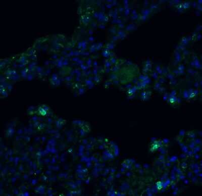 Immunohistochemistry: TMEM41B Antibody - BSA Free [NBP3-12857]