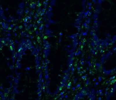 Immunohistochemistry: TMEM41B Antibody - BSA Free [NBP3-12858]