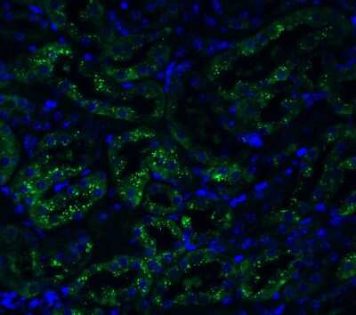 Immunohistochemistry: TMEM41B Antibody - BSA Free [NBP3-12858]