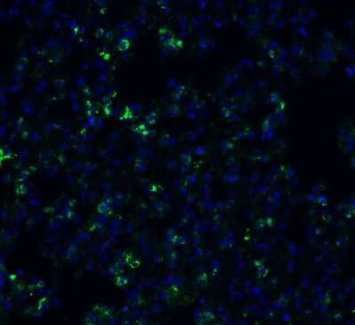 Immunohistochemistry: TMEM41B Antibody - BSA Free [NBP3-12858]