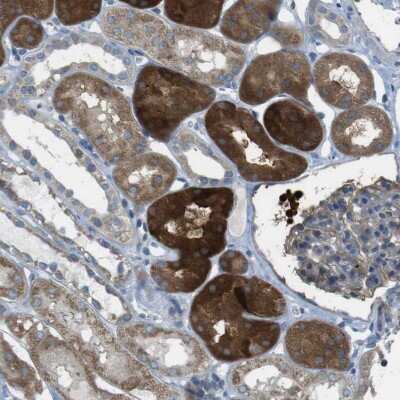 Immunohistochemistry-Paraffin: TMEM41B Antibody [NBP1-81552]