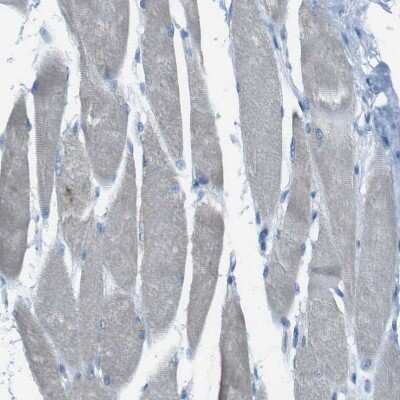 Immunohistochemistry-Paraffin: TMEM41B Antibody [NBP1-81552]