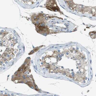 Immunohistochemistry-Paraffin: TMEM41B Antibody [NBP1-81552]