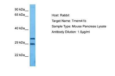 Western Blot: TMEM41B Antibody [NBP2-83692]