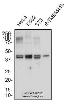 Western Blot: TMEM41B Antibody [NBP3-00527]