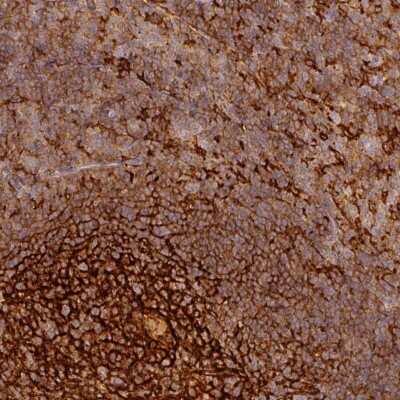 Immunohistochemistry-Paraffin: TMEM42 Antibody [NBP2-30855]