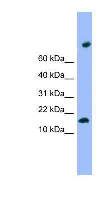 Western Blot: TMEM42 Antibody [NBP1-57740]