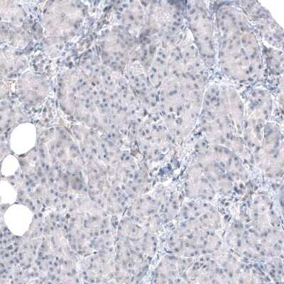 Immunohistochemistry-Paraffin: TMEM43 Antibody [NBP1-84132]
