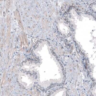 Immunohistochemistry-Paraffin: TMEM43 Antibody [NBP1-84132]