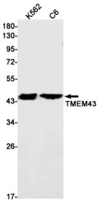 Western Blot: TMEM43 Antibody (S07-9D4) [NBP3-19789]