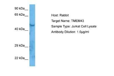 Western Blot: TMEM43 Antibody [NBP2-83693]