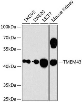 Western Blot: TMEM43 AntibodyBSA Free [NBP2-94726]