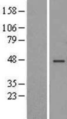 Western Blot: TMEM43 Overexpression Lysate [NBL1-17080]