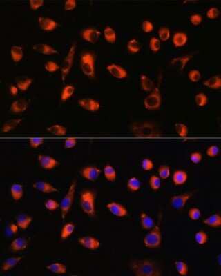 Immunocytochemistry/ Immunofluorescence: TMEM44 Antibody - Azide and BSA Free [NBP2-94005]